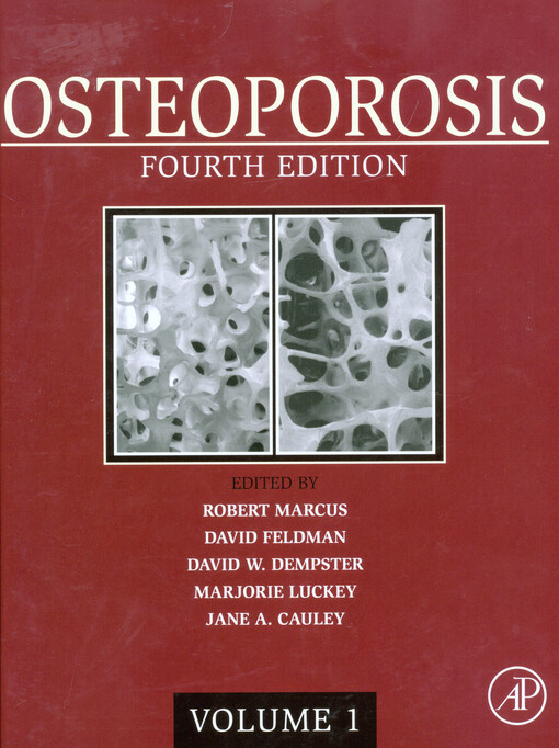Osteoporosis.Volume 1