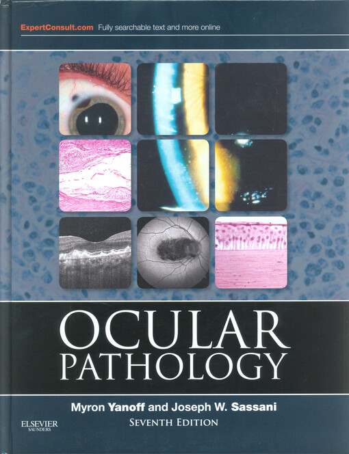 Ocular pathology