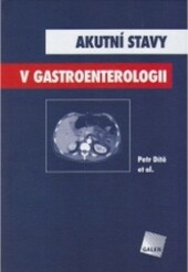 Akutní stavy v gastroenterologii