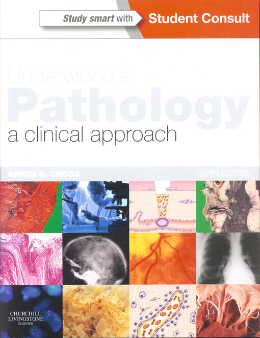 Underwood's Pathology: a Clinical Approach: with STUDENT CONSULT Access, 6e, 2013.    