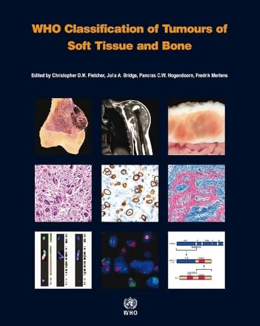 WHO classification of tumours of soft tissue and bone
