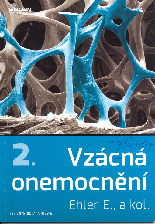 Vzácná onemocnění