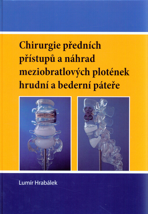 Chirurgie předních přístupů a náhrad meziobratlových plotének hrudní a bederní páteře