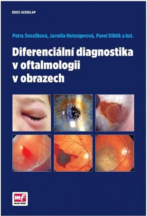 Diferenciální diagnostika v oftalmologii v obrazech