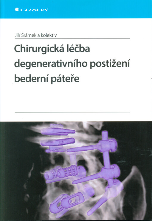 Chirurgická léčba degenerativního postižení bederní páteře