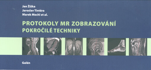 Protokoly MR Zobrazování