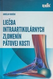 Liečba intraartikulárnych zlomenín pätovej kosti
