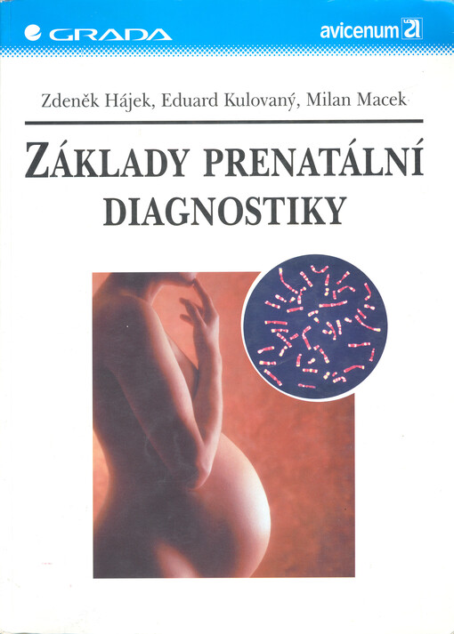 Základy prenatální diagnostiky.