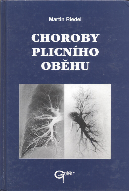 Choroby plicního oběhu