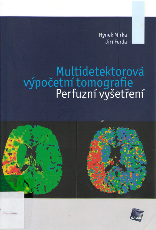 Multidetektorová výpočetní tomografie : perfuzní vyšetření