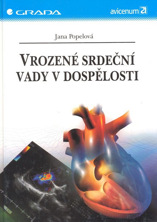 Vrozené srdeční vady v dospělosti