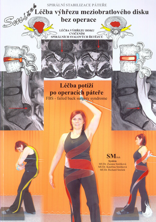 Spirální stabilizace páteře : léčba výhřezu meziobratlového disku bez operace : metoda Spirální stabilizace páteře : SMíšek Systém