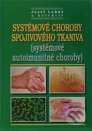 Systémové choroby spojivového tkaniva