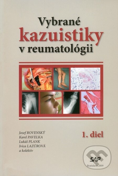 Vybrané kazuistiky v reumatológii