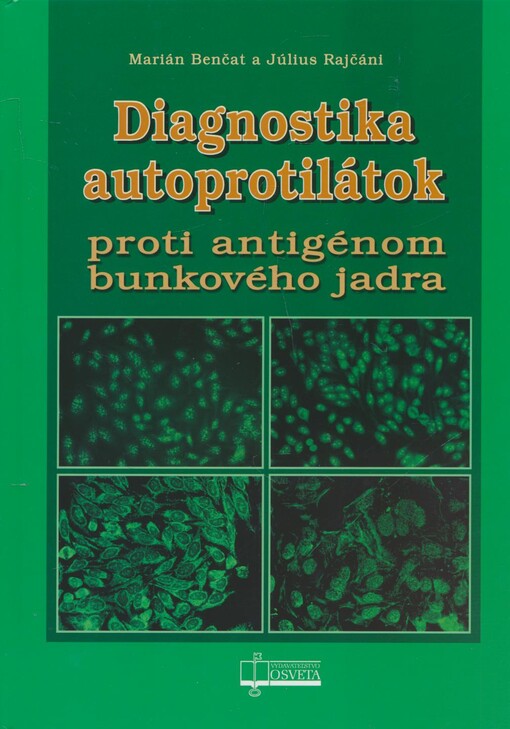 Diagnostika autoprotilátok proti antigénom bunkového jadra