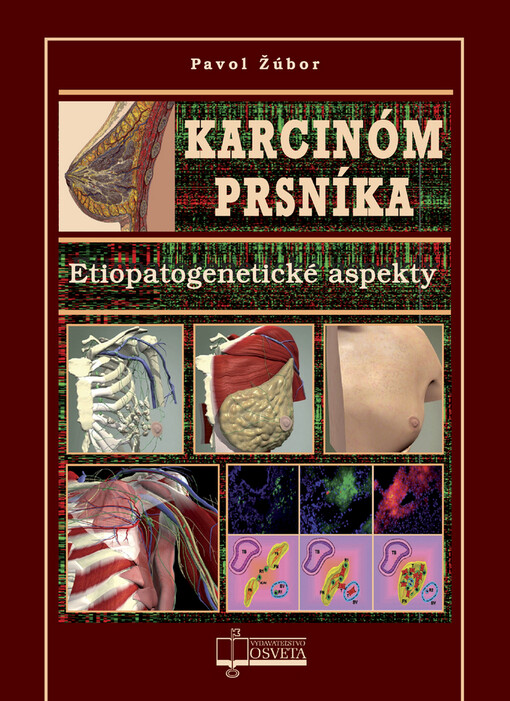Karcinom prsníka :etiopatogenetické aspekty