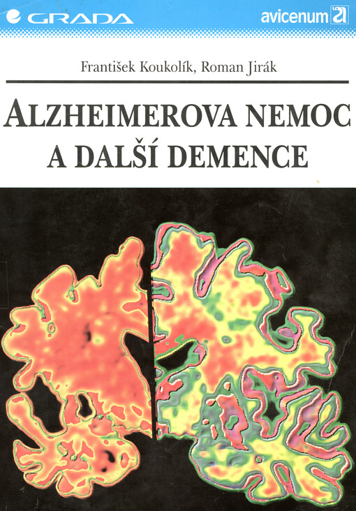 Alzheimerova nemoc a další demence