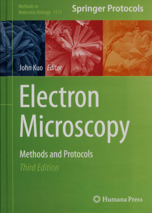 Electron microscopy : methods and protocols