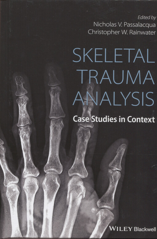 Skeletal trauma analysis : case studies in context