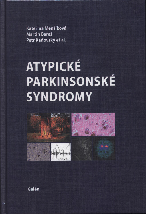 Atypické parkinsonské syndromy