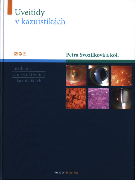 Uveitidy v kazuistikách