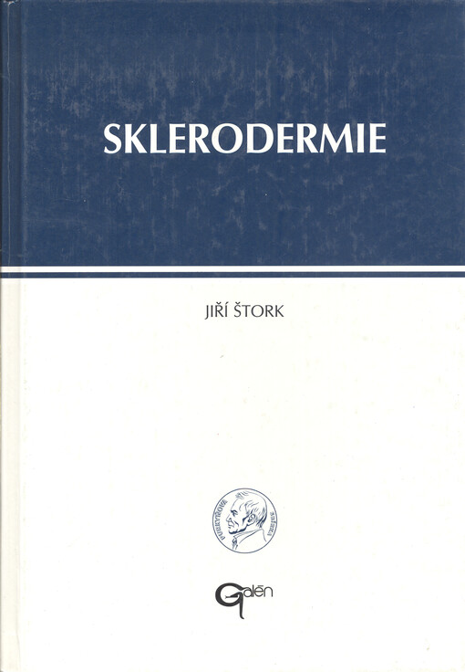 Sklerodermie