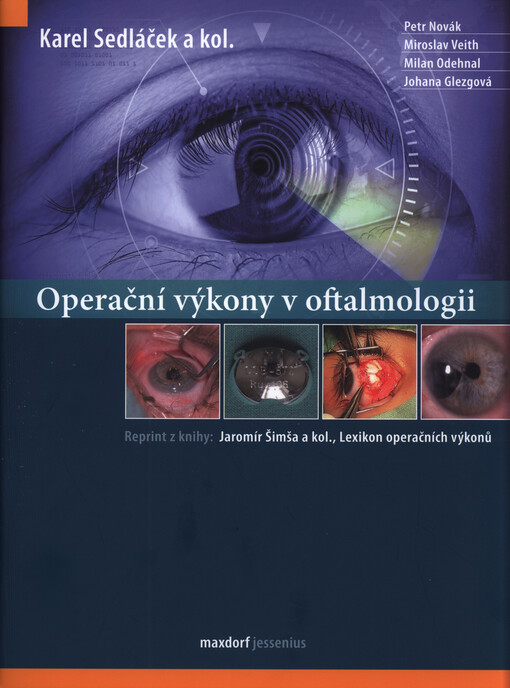 Operační výkony v oftalmologii