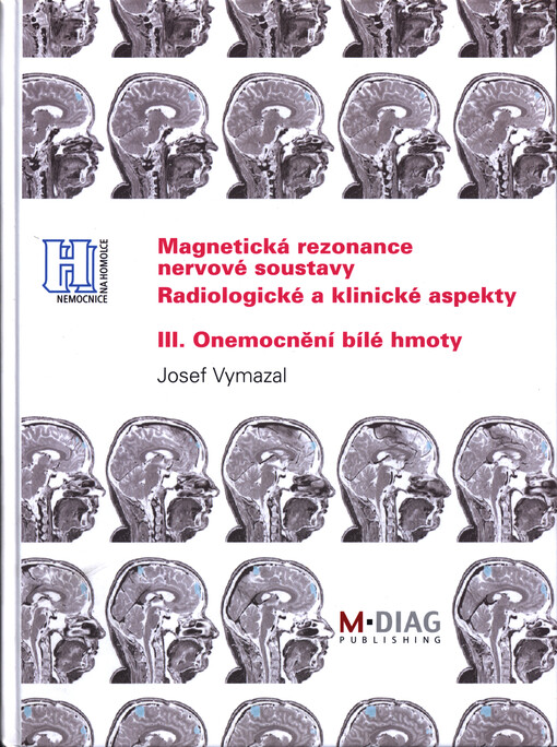 Magnetická rezonance nervové soustavy :radiologické a klinické aspekty.III.,Onemocnění bílé hmoty