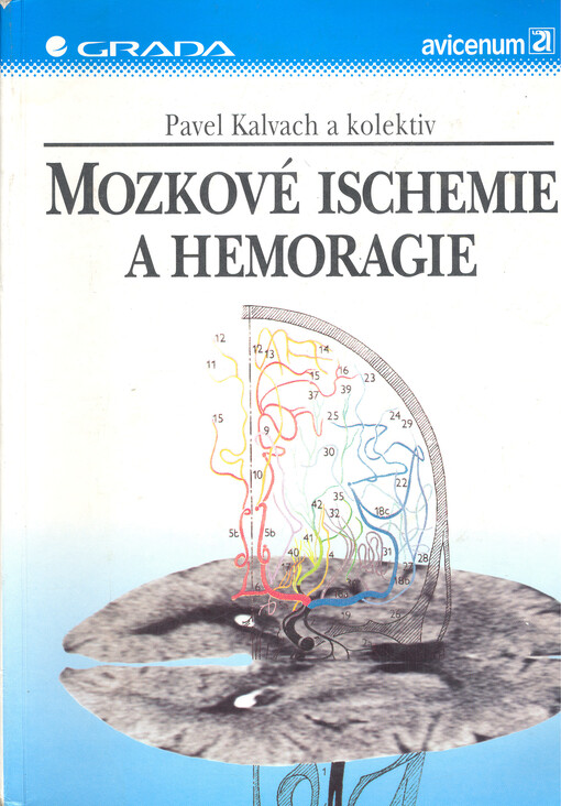 Mozkové ischemie a hemoragie