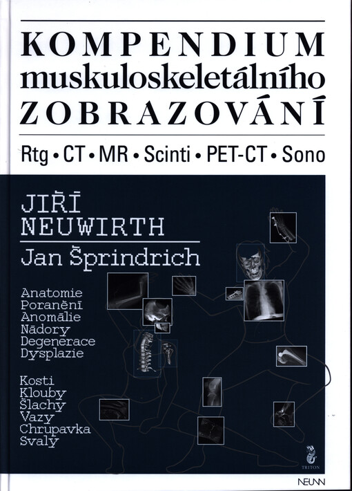 Kompendium muskuloskeletálního zobrazování