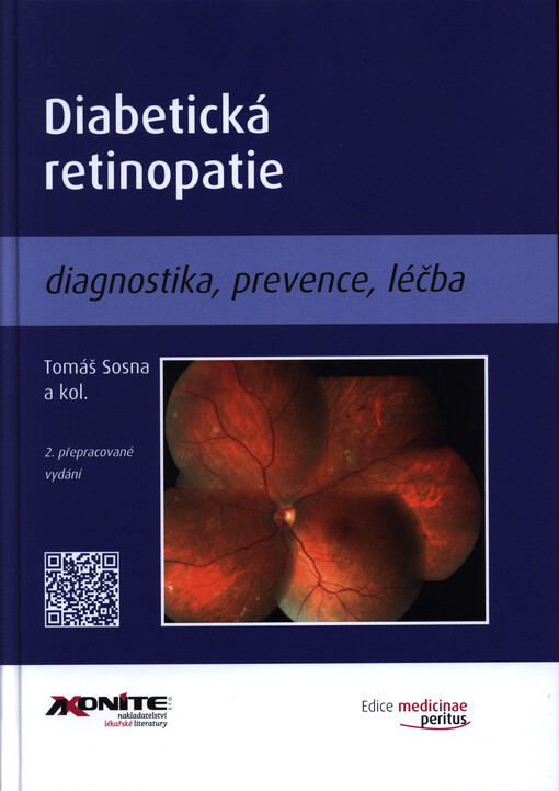 Diabetická retinopatie : diagnostika, prevence, léčba