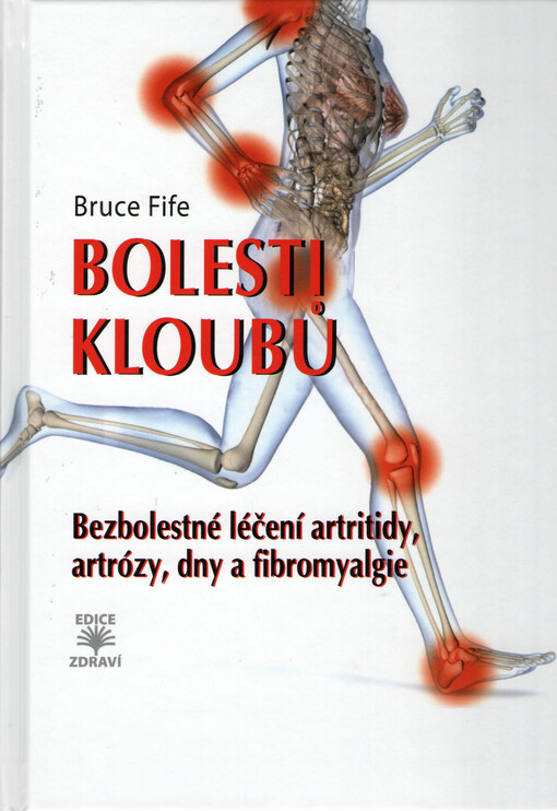 Bolesti kloubů