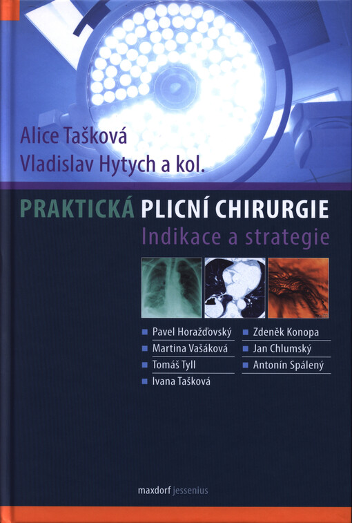 Praktická plicní chirurgie