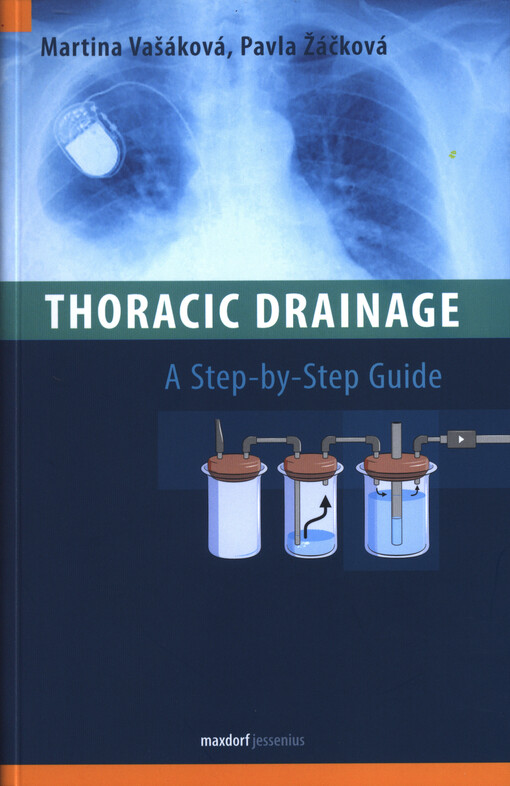 Thoracic Drainage A Step-by-Step Guide