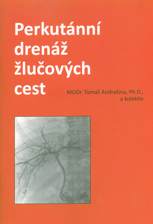 Perkutánní drenáž žlučových cest