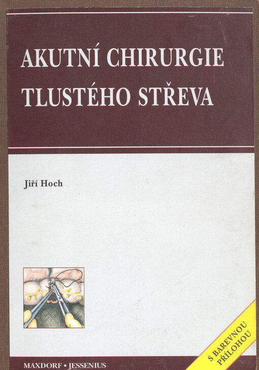 Akutní chirurgie tlustého střeva