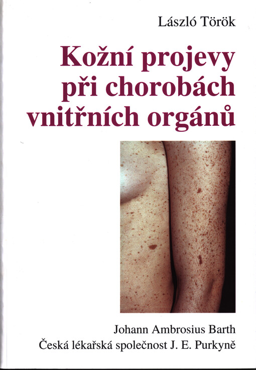 Kožní projevy při chorobách vnitřních orgánů
