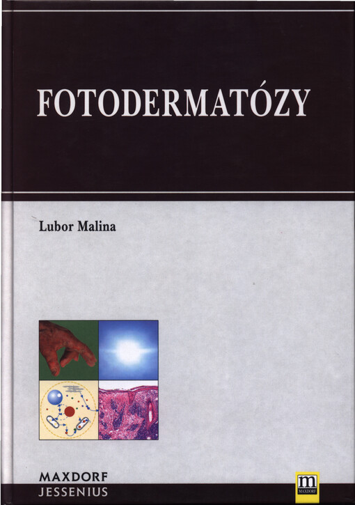 Fotodermatózy