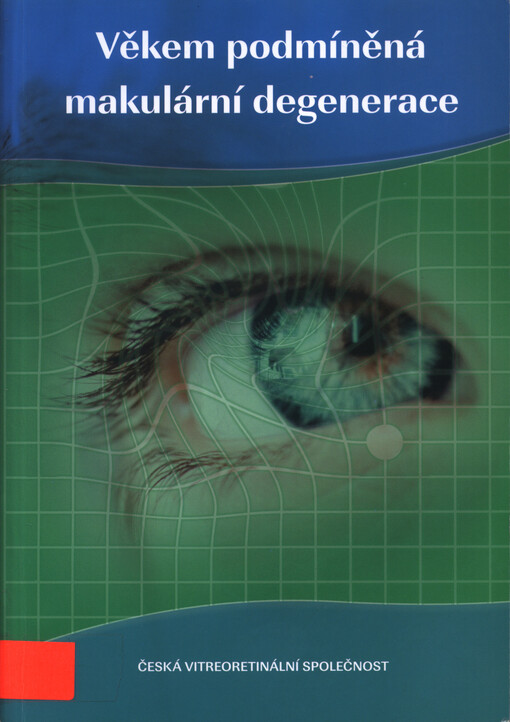 Věkem podmíněná makulární degenerace (VPMD)
