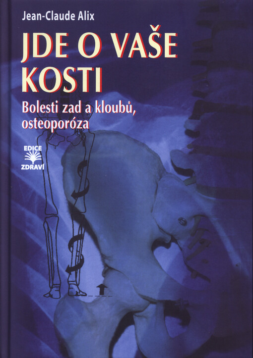Jde o vaše kosti