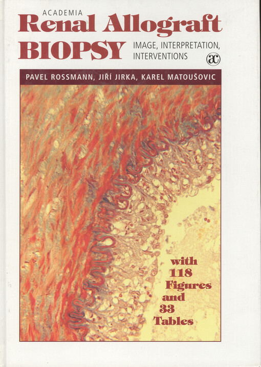 Renal allograft biopsy :image, interpretation, interventions