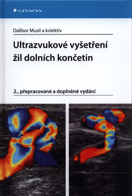 Ultrazvukové vyšetření žil dolních končetin | Musil Dalibor, kolektiv - e-kniha