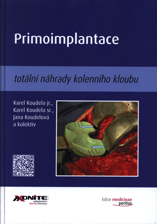 Primoimplantace totální náhrady kolenního kloubu