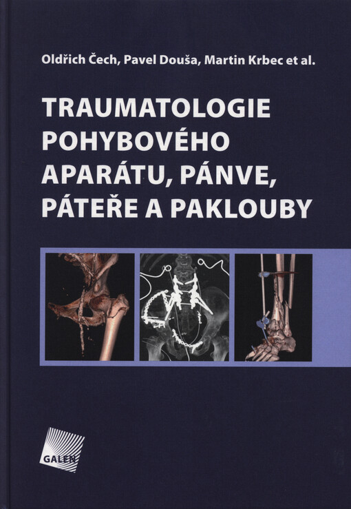 Traumatologie pohybového aparátu, pánve, páteře a paklouby