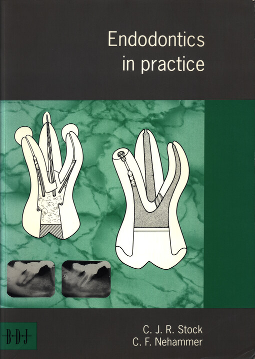 Endodontics in Practice