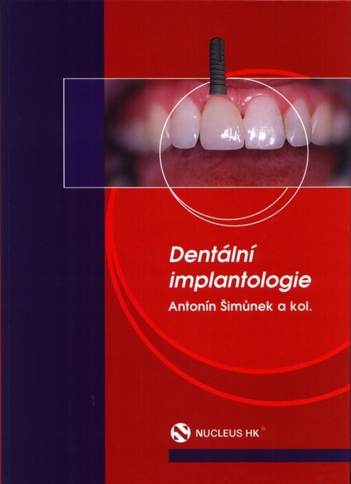 Dentální implantologie