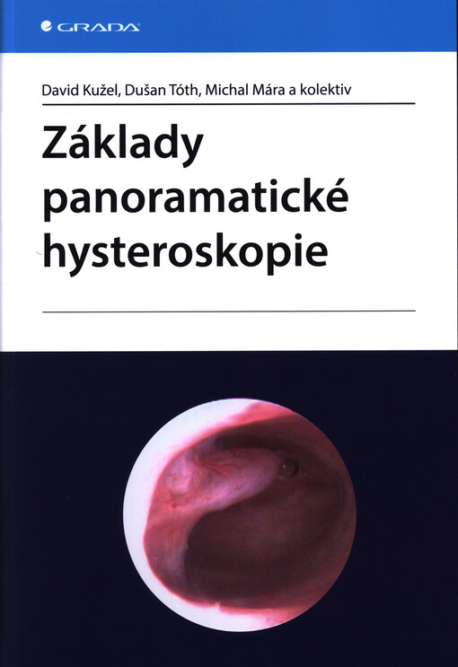 Základy panoramatické hysteroskopie | Kužel David, Tóth Dušan, Mára Michal, kolektiv - e-kniha