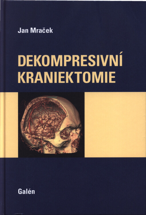 Dekompresivní kraniektomie