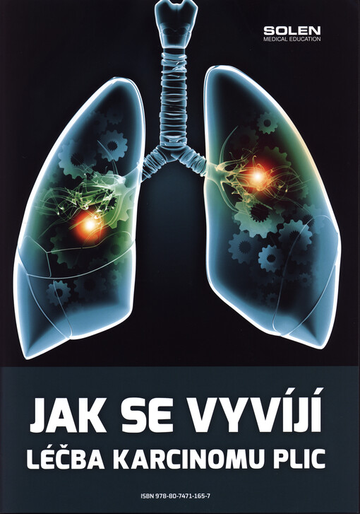 Jak se vyvíjí léčba karcinomu plic