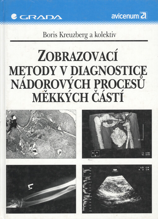 Zobrazovací metody v diagnostice nádorových procesů měkkých částí